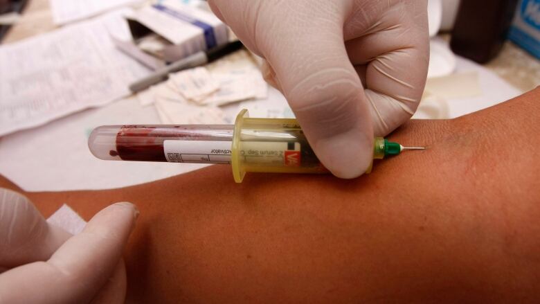 a needle in an arm draws blood