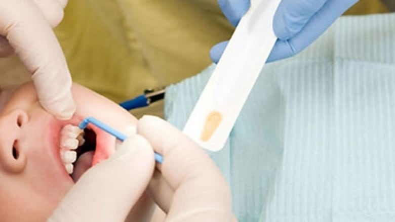 A child opens wide as a dentist and assistant use tools to work on his teeth.