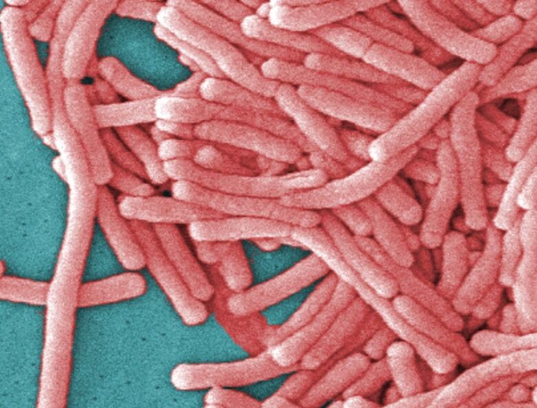 An up-closed electron micrograph image of a pink-coloured bacteria on a teal blue background