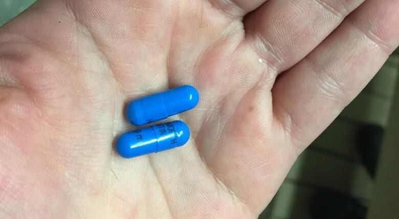 Two blue pills in an open palm.