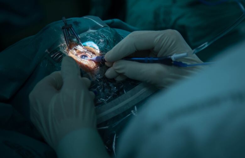 A doctor's gloved hands are shown in closeup as they perform a cataract surgery on a patient's wide open eye.