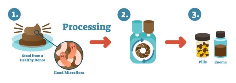 A cartoon drawing shows the steps for producing fecal microbiota transplants, going from taking the 'good microflora' from the 'stool from a healthy donor,' through the processing and then production of pills and enemas.