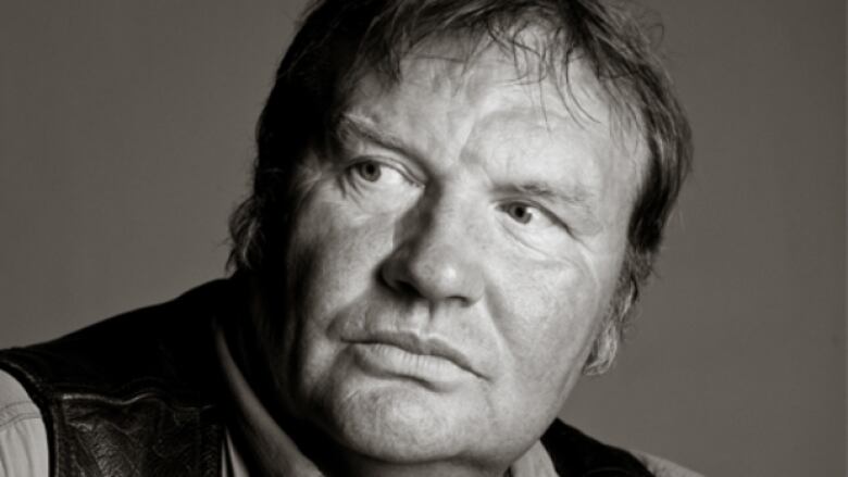 A white man in black and white looks at the camera with his hand on his forehead.