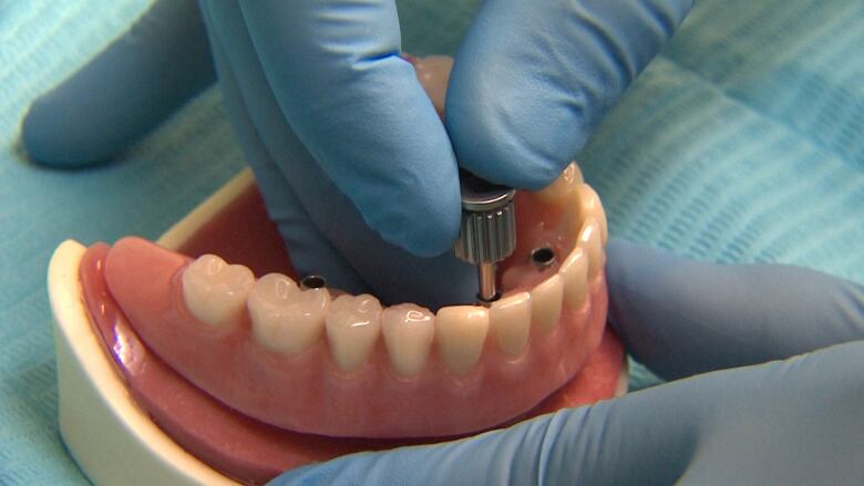 A denturist works on a set of fake teeth. 