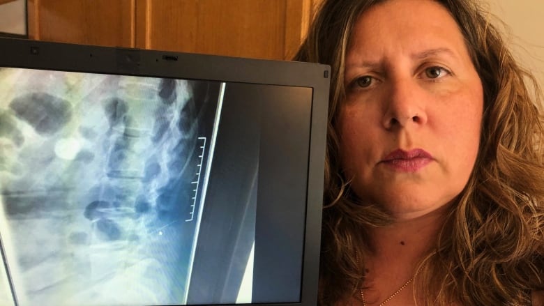 A woman holds up an x-ray.