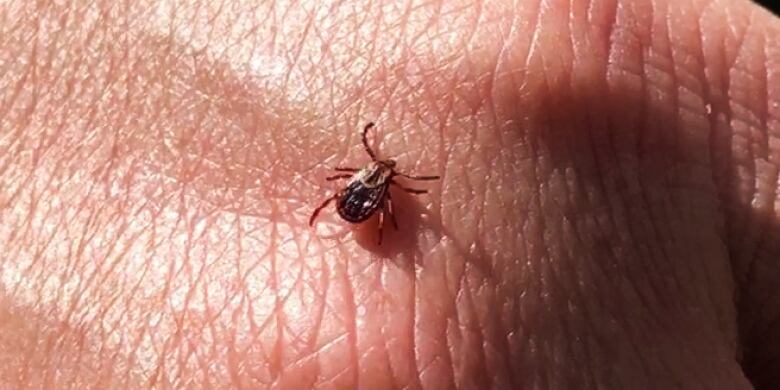 Tick on a hand.