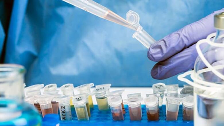 Close-up of a gloved hand holding a test tube and syringe, 