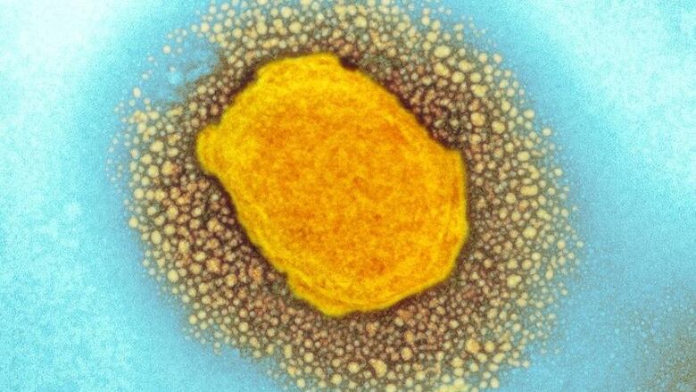 This image shows a monkeypox virus particle, that has been coloured, taken by a type of microscope called a transmission electron micrograph.