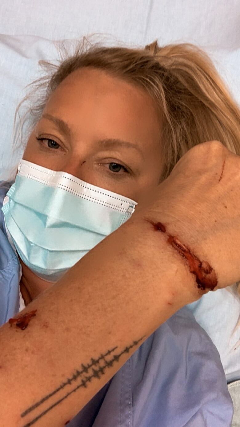 A woman wearing a surgical mask holds up her arm to show gashes near her wrist.