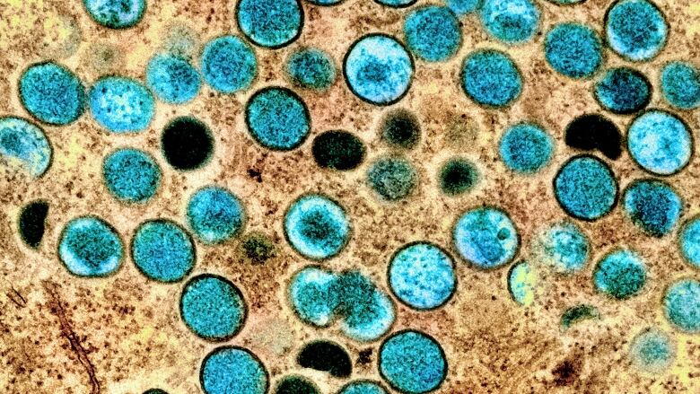 Microscope image showing teal cells against brown cells