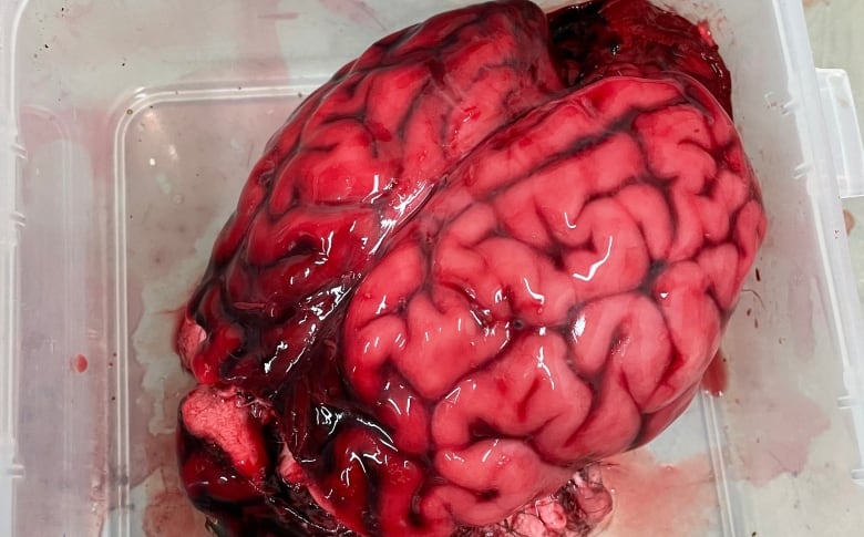 A deer brain sits in a plastic container.