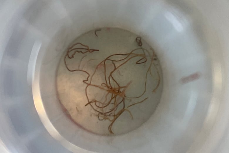 Small string-like worms lie in a container.