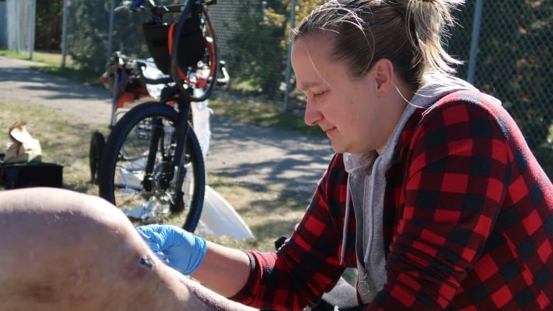 A woman changes the dressing on the leg of a man, whose face isn't showing, who lives in a homeless encampment