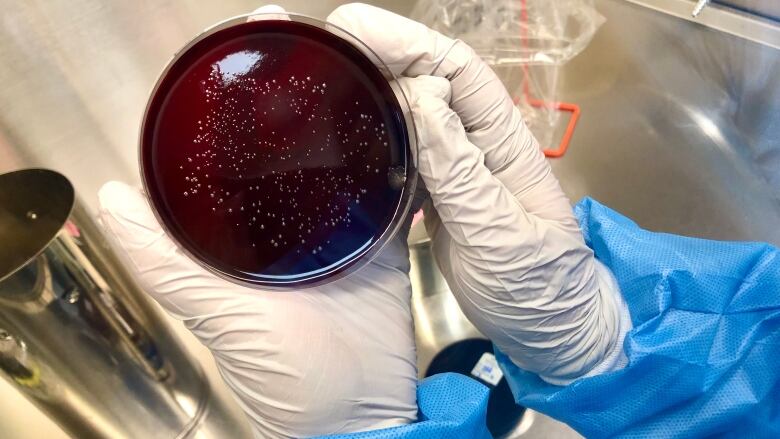 A gloved hand holds a Petri Dish.