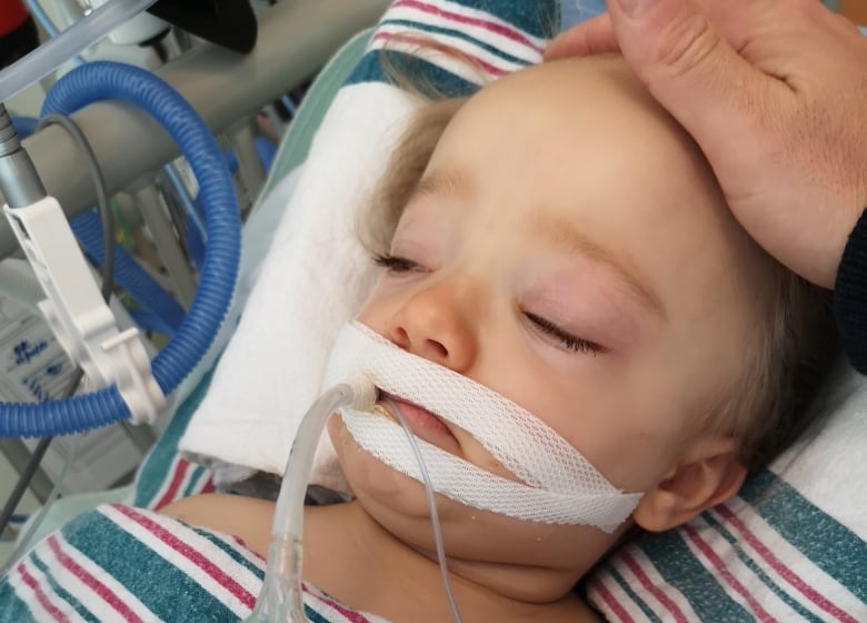 A toddler lies in a hospital bed with a tube in her mouth.