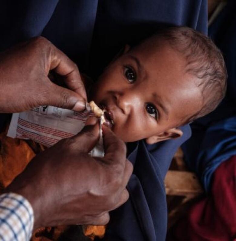 An eight-month-old child receives high nutrition foods