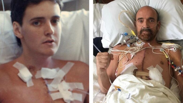 A composite image. On the left a young man in a hospital bed in 1986, following a heart transplant. He is awake and raising his fist to the camera in a gesture of strength. On the right, the same man in a hospital bed in 2019, following another transplant. He is awake and making the same gesture to the camera.