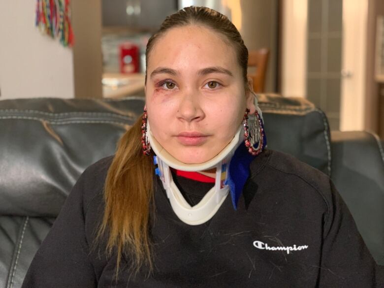 A woman looks at the camera. She has a black eye, her hair in a ponytail, and is wearing a neck brace.