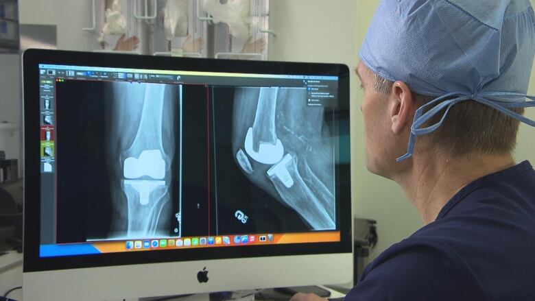 A doctor looks at a computer screen showing images of a patient's knee replacement surgery.