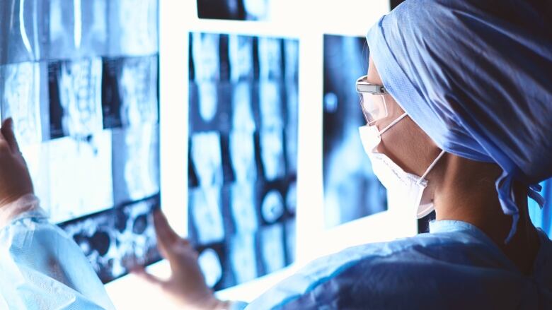 A woman in scrubs and a face mask looks at x-ray images