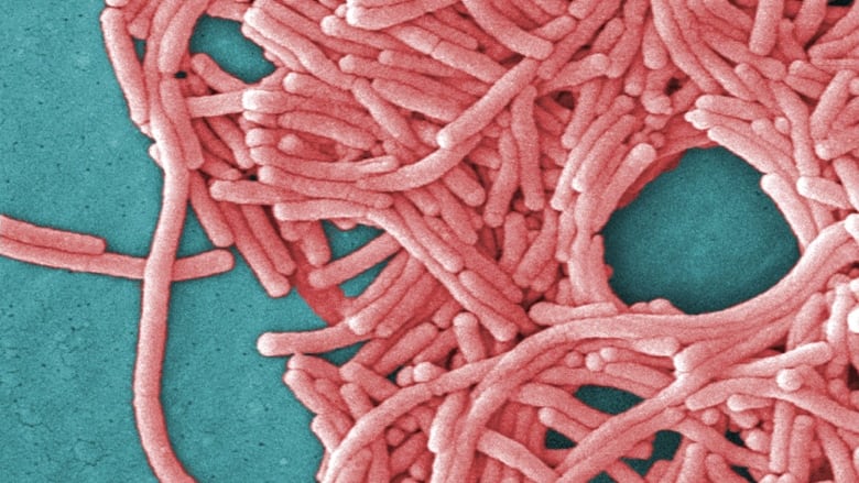 A graphic of the legionella bacteria.