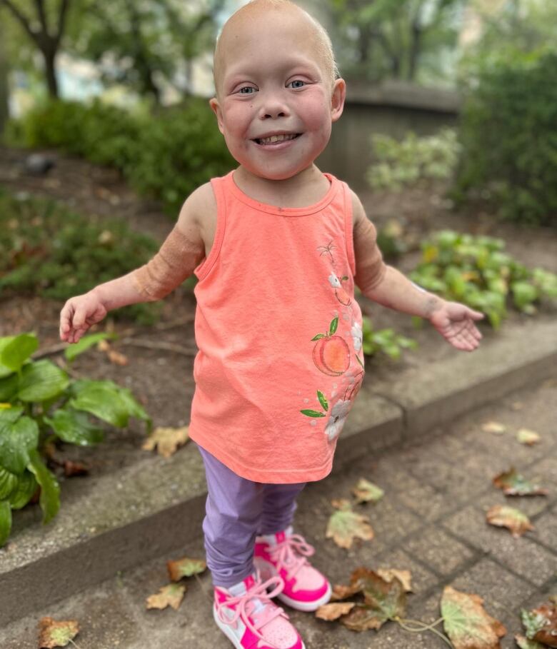 A little girl with white skin, and little blonde hair is standing on a brick park pathway. She is smiling, wearing a peach tanktop, purple sweatpants and pink Nike high-top sneakers. Her arms are bandaged.