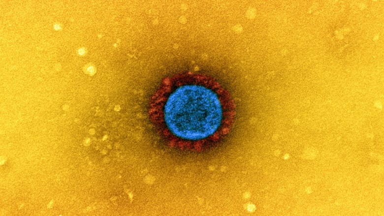 Transmission electron micrograph of a SARS-CoV-2 virus particle isolated from a patient sample and cultivated in cell culture. The prominent projections (red) seen on the outside of the virus particle (blue) are spike proteins. This fringe of proteins enables the virus to attach to and infect host cells and then replicate. Image captured at the NIAID Integrated Research Facility (IRF) in Fort Detrick, Maryland. Credit: NIAID