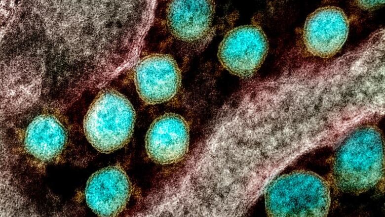 Transmission electron micrograph of SARS-CoV-2 virus particles, isolated from a patient.