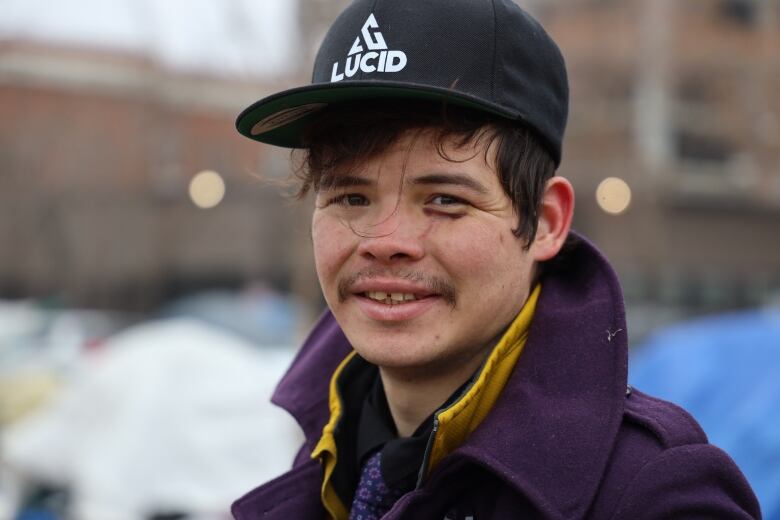 A man in a black ballcap and purple jacket stares at the camera. He has bruising on his eye. 