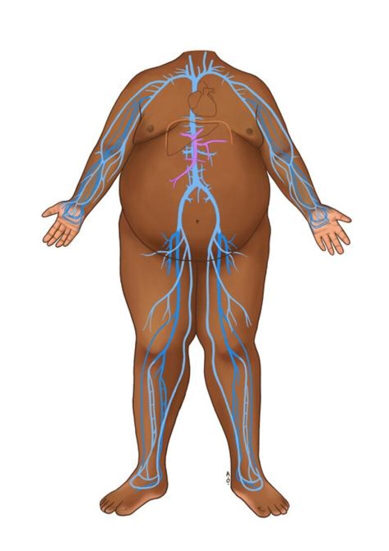 An anatomy illustration of a person with a different body composition and with a darker skin tone