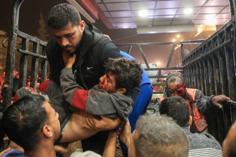 People with blood on their faces are helped off the back of a truck.