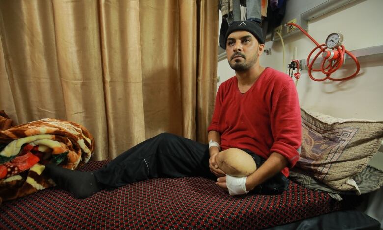 A man in a red shirt and black track pants is sitting on a mattress in hospital. His left leg has been amputated above the knee. There is a pillow behind him and a blanket beside his right leg. 