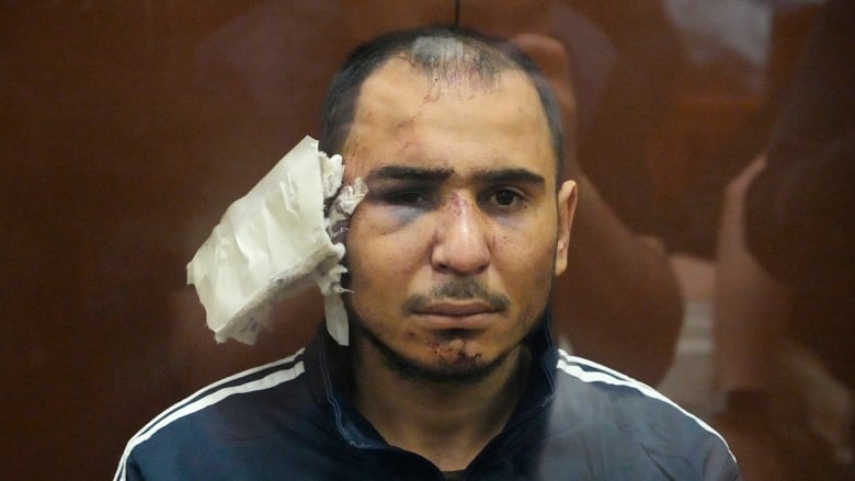 A person with bruises and bandages on their face is seen behind a glass.