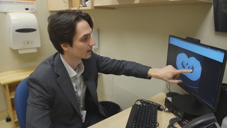 Doctor Daniel Marinescu, a respirologist, points to a patient's CT scan. He points out scarring on the lungs of the patient which can occur after long COVID. 