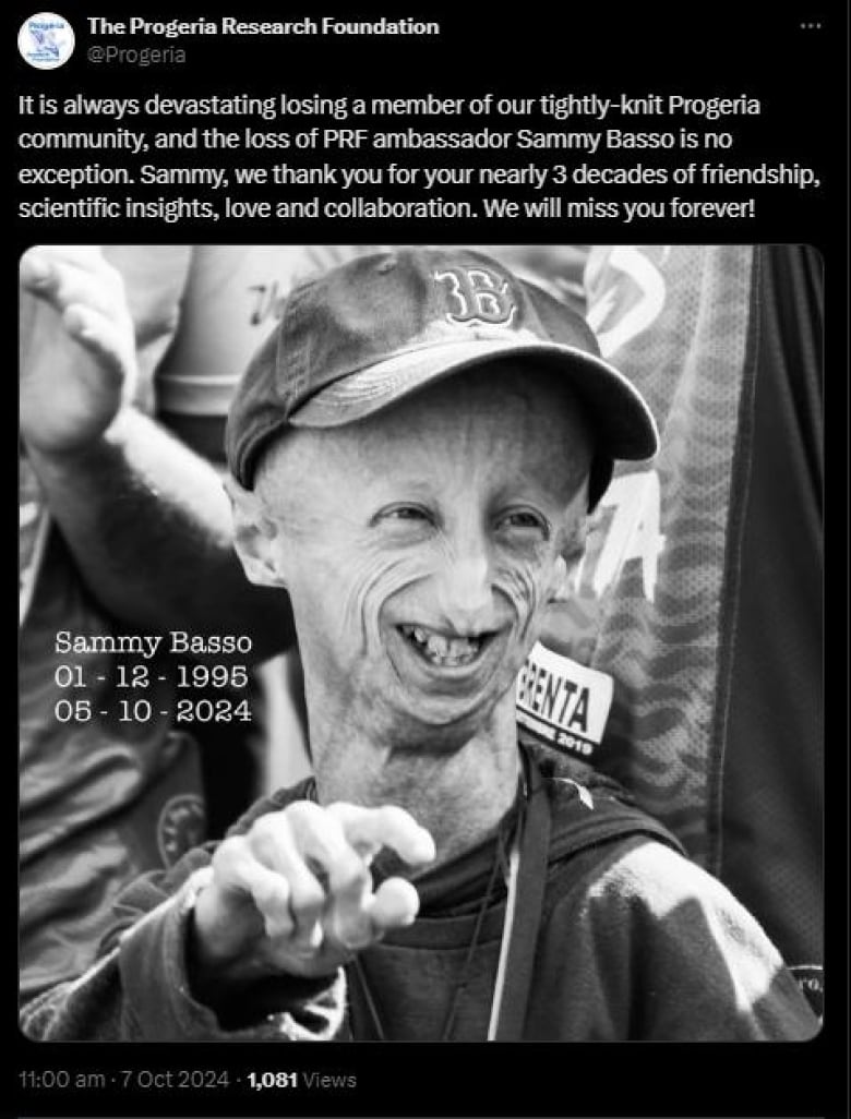 A post on X from the Progeria Research Foundation, featuring a black and white photo of a young man with a large head and wrinkled skin smiling brightly. Text on the photo reads: 