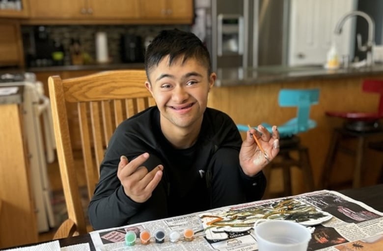 A child with Down syndrome plays with a painting kit.