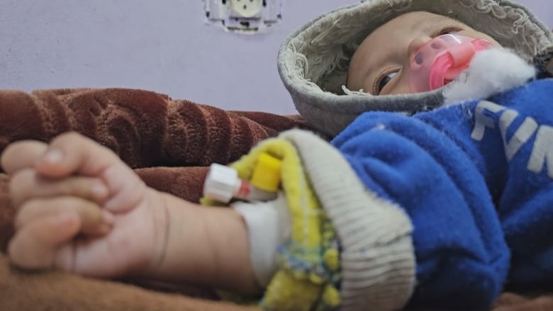 An infant receives treatment.